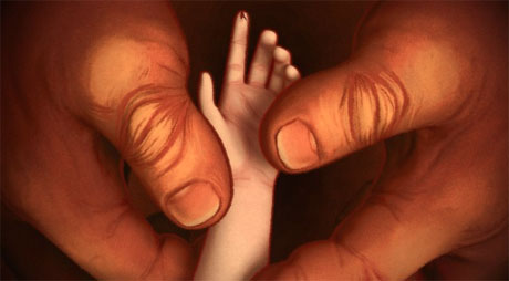 INTERVIEW: The Challenges Of Challenging "Pachyderme" 14 Pachyderme2 460